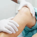 Knee replacement surgery