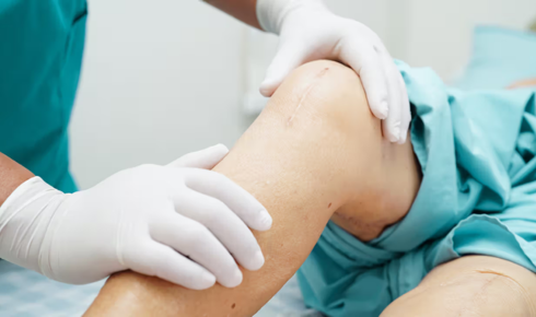 Knee replacement surgery